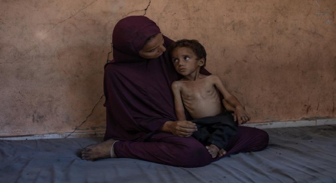 Gazze’de açlıktan ölenlerin sayısı 127’ye yükseldi