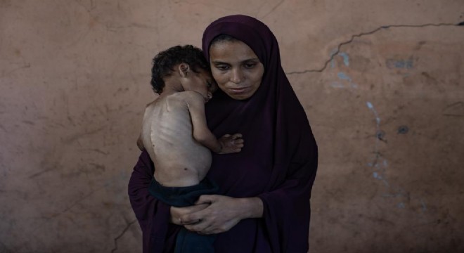 Gazze’de açlıktan ölenlerin sayısı 159’a yükseldi