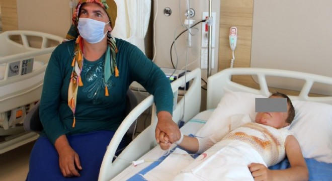Gömleğindeki ipi yakmak isterken kendini yaktı